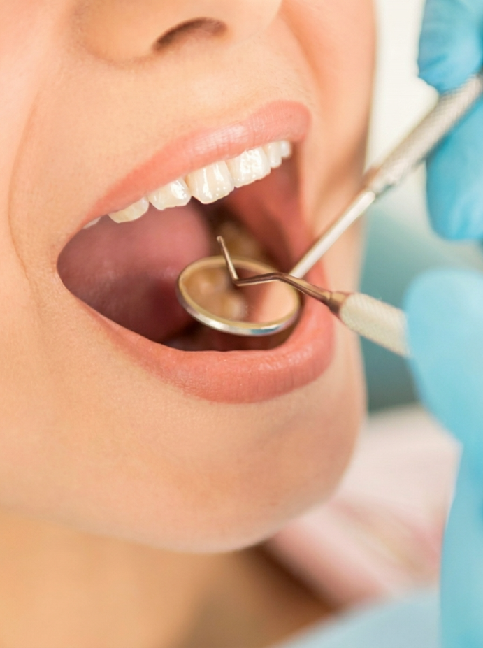 Oral Cancer Screening